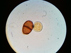 Puccinia orbicula