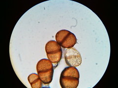 Puccinia orbicula