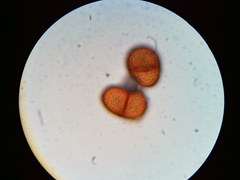 Puccinia orbicula