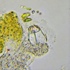 Cephalodella sterea