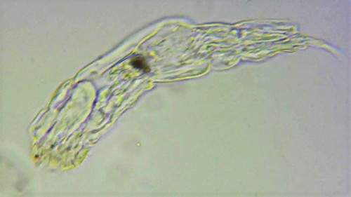 Cephalodella sterea