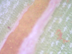 Puccinia asparagi