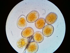Puccinia asparagi