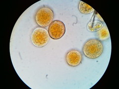 Puccinia asparagi