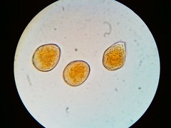 Puccinia asparagi