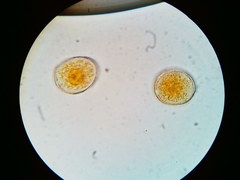 Puccinia asparagi