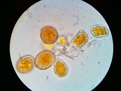 Puccinia asparagi