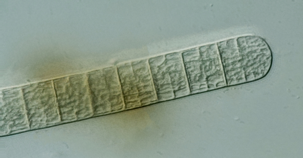 Tychonema bornetii