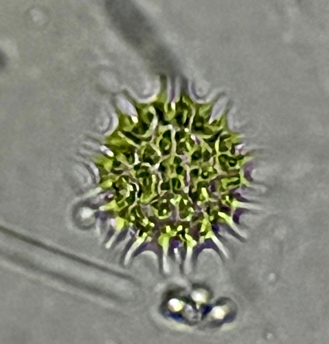 Pseudopediastrum boryanum observed 2026-10-19