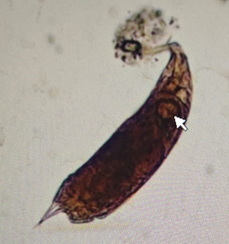 Trichocerca similis