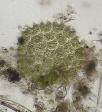 Pseudopediastrum boryanum observed 2026-10-18