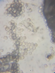 Microbotryum pinguiculae