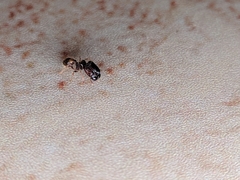 Pheidole