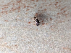 Pheidole