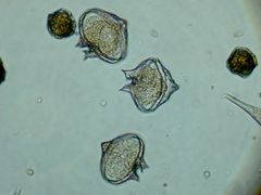 Protoperidinium