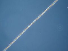 Pseudo-nitzschia seriata