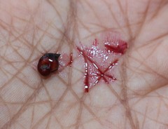 Cocculus hirsutus
