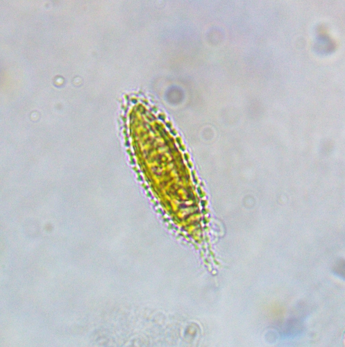 Mallomonas insignis · iNaturalist