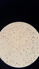 Clitocybe eccentrica