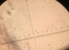 Dacryobolus karstenii