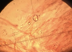 Dacryobolus karstenii