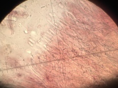 Dacryobolus karstenii