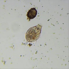 Lecane closterocerca