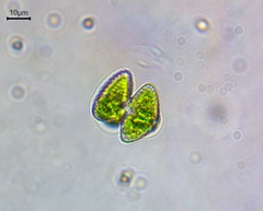 Staurastrum punctulatum