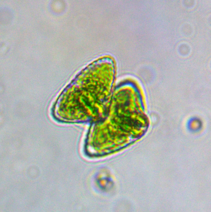 Staurastrum punctulatum