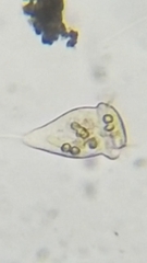 Vorticella