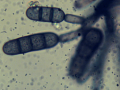 Kirschsteiniothelia atra