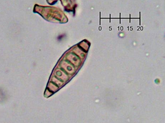 Pseudospiropes simplex