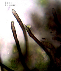 Pseudospiropes simplex