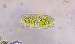 Cylindrocystis