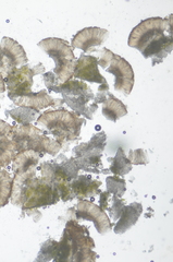 Psoroma hypnorum