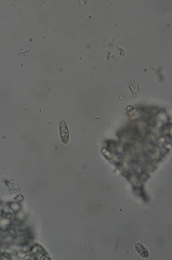 Psoroma hypnorum