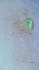 Miridae