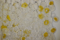 Aecidium ranunculi-acris