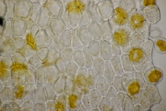Aecidium ranunculi-acris