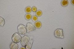 Aecidium ranunculi-acris
