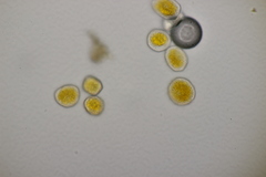Aecidium ranunculi-acris