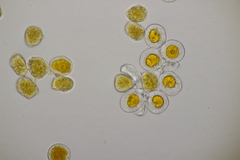 Aecidium ranunculi-acris