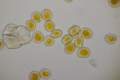 Aecidium ranunculi-acris