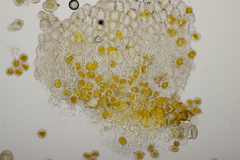 Aecidium ranunculi-acris