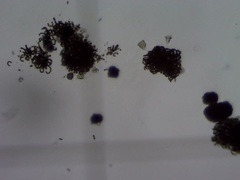 Dolichospermum lemmermannii