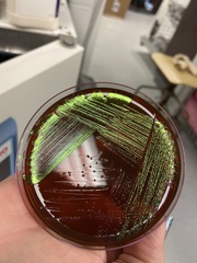 Escherichia coli