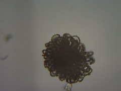 Dolichospermum lemmermannii