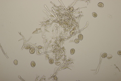 Peronospora ranunculi