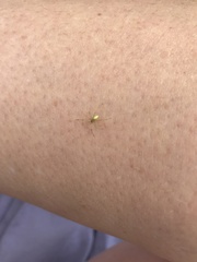 Enoplognatha ovata