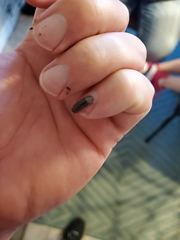 Armadillidium nasatum